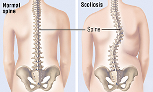 Dorsal Area Page